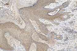 Involucrin Rabbit Polyclonal Antibody, Proteintech:Antibodies:Primary Antibodies