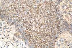 Involucrin Rabbit Polyclonal Antibody, Proteintech:Antibodies:Primary Antibodies