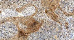 Involucrin Rabbit Polyclonal Antibody, Proteintech:Antibodies:Primary Antibodies