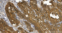 Involucrin Rabbit Polyclonal Antibody, Proteintech:Antibodies:Primary Antibodies