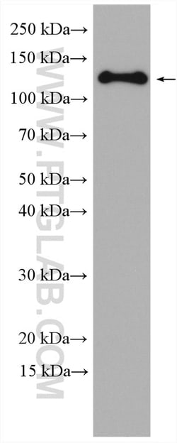 Involucrin Rabbit Polyclonal Antibody, Proteintech:Antibodies:Primary Antibodies