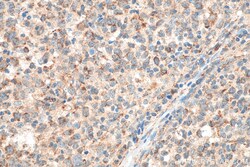 JAK3 Rabbit Recombinant Antibody, Proteintech:Antibodies:Primary Antibodies