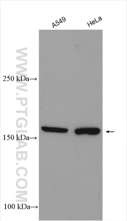 JMJD3 Rabbit Polyclonal Antibody, Proteintech