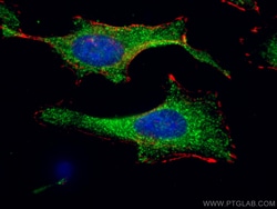 KBTBD2 Mouse Monoclonal Antibody, Proteintech