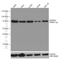 KBTBD2 Mouse Monoclonal Antibody, Proteintech:Anticuerpos:Anticuerpos primarios