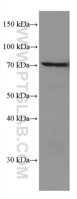 KBTBD2 Mouse Monoclonal Antibody, Proteintech:Anticuerpos:Anticuerpos primarios