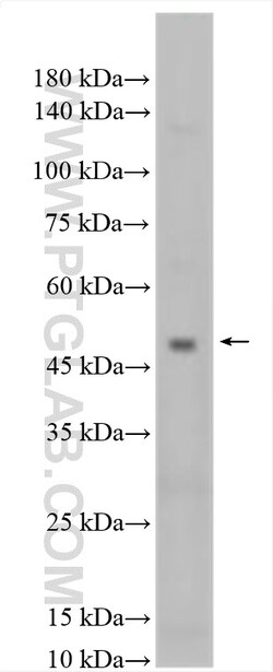 KCNK12 Rabbit Polyclonal Antibody, Proteintech Unconjugated; 20 &mu;L:Antibodies,