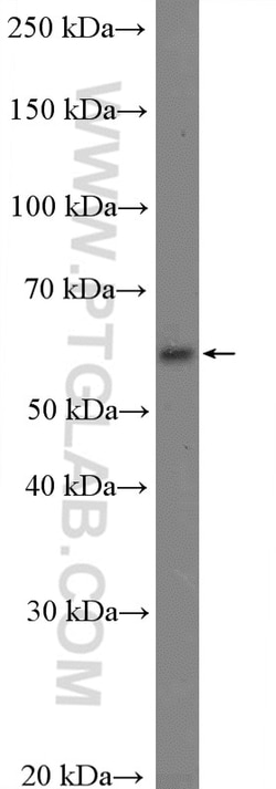 KCNS3 Rabbit Polyclonal Antibody, Proteintech Unconjugated; 20 &mu;L:Antibodies,