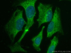 CoraLite Plus 488-conjugated KEAP1 Mouse Monoclonal Antibody, Proteintech:Antibodies:Primary
