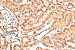 VIRMA/KIAA1429 Rabbit Polyclonal Antibody, Proteintech Unconjugated; 150