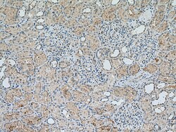 EPG5 Rabbit Polyclonal Antibody, Proteintech Unconjugated; 150 &mu;L:Antibodies,