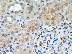 EPG5 Rabbit Polyclonal Antibody, Proteintech Unconjugated; 150 &mu;L:Antibodies,