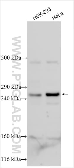 EPG5 Rabbit Polyclonal Antibody, Proteintech Unconjugated; 150 &mu;L:Antibodies,