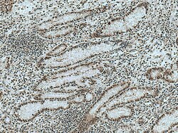 KIF23 Rabbit Polyclonal Antibody, Proteintech 150 &mu;L | Buy Online | Proteintech | Fisher Scientific