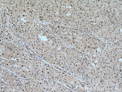 KIF23 Rabbit Polyclonal Antibody, Proteintech 150 &mu;L | Buy Online | Proteintech | Fisher Scientific