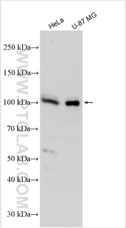 KIF23 Rabbit Polyclonal Antibody, Proteintech 150 &mu;L | Buy Online | Proteintech | Fisher Scientific