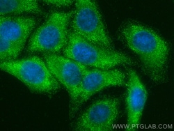 KIF5B Rabbit Recombinant Antibody, Proteintech:Antibodies:Primary Antibodies