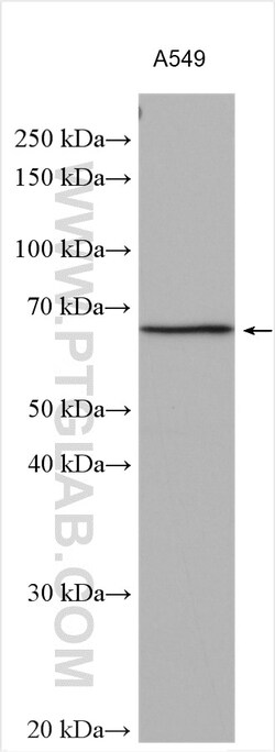 KLHL25 Rabbit Polyclonal Antibody, Proteintech Unconjugated; 20 &mu;L:Antibodies,