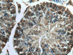 KLHL25 Mouse Monoclonal Antibody, Proteintech:Antibodies:Primary Antibodies