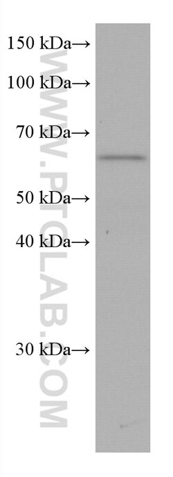 KLHL25 Mouse Monoclonal Antibody, Proteintech:Antibodies:Primary Antibodies