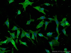 KLK8 Mouse Monoclonal Antibody, Proteintech Unconjugated; 150 &mu;L:Antibodies,