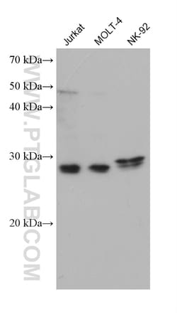 KLK8 Mouse Monoclonal Antibody, Proteintech Unconjugated; 150 &mu;L:Antibodies,