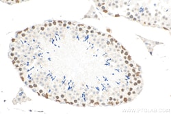 KPNA3 Mouse Monoclonal Antibody, Proteintech Unconjugated; 150 &mu;L:Antibodies,