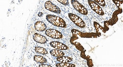 Cytokeratin 20 Rabbit Recombinant Antibody, Proteintech:Antibodies:Primary