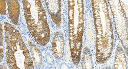 Cytokeratin 20 Rabbit Recombinant Antibody, Proteintech:Antibodies:Primary