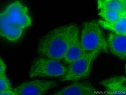Cytokeratin 20 Rabbit Recombinant Antibody, Proteintech:Antibodies:Primary