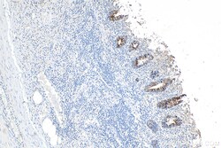 Cytokeratin 20 Rabbit Recombinant Antibody, Proteintech:Antibodies:Primary