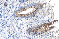 Cytokeratin 20 Rabbit Recombinant Antibody, Proteintech:Antibodies:Primary