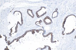 Cytokeratin 20 Rabbit Recombinant Antibody, Proteintech:Antibodies:Primary