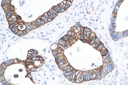 Cytokeratin 20 Rabbit Recombinant Antibody, Proteintech:Antibodies:Primary