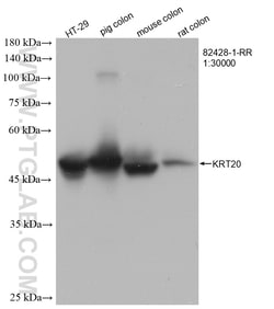 Cytokeratin 20 Rabbit Recombinant Antibody, Proteintech:Antibodies:Primary