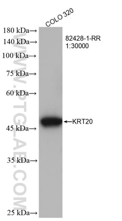 Cytokeratin 20 Rabbit Recombinant Antibody, Proteintech:Antibodies:Primary