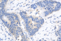 Biotin-conjugated KRT80 Rabbit Polyclonal Antibody, Proteintech 20 &mu;L | Buy Online | Proteintech | Fisher Scientific