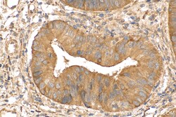 Biotin-conjugated KRT80 Rabbit Polyclonal Antibody, Proteintech 20 &mu;L | Buy Online | Proteintech | Fisher Scientific