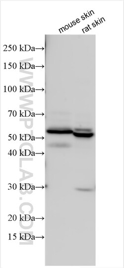 KRT86 Rabbit Polyclonal Antibody, Proteintech:Antibodies:Primary Antibodies