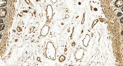 Kindlin 2 Rabbit Polyclonal Antibody, Proteintech Unconjugated; 20 &mu;L:Antibodies,