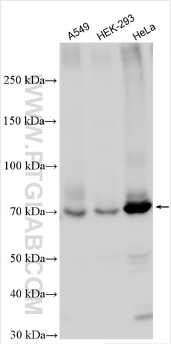 Kindlin 2 Rabbit Polyclonal Antibody, Proteintech Unconjugated; 20 &mu;L:Antibodies,