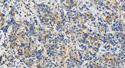 LACC1 Rabbit Polyclonal Antibody, Proteintech:Antibodies:Primary Antibodies