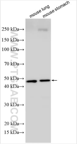 LACC1 Rabbit Polyclonal Antibody, Proteintech:Antibodies:Primary Antibodies