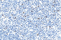 LAG-3/CD223 Rabbit Polyclonal Antibody, Proteintech Unconjugated; 20 &mu;L:Antibodies,