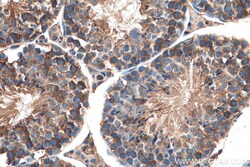 LARP2 Rabbit Polyclonal Antibody, Proteintech:Anticuerpos:Anticuerpos primarios