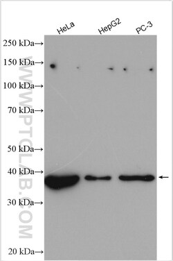 LARP2 Rabbit Polyclonal Antibody, Proteintech:Anticuerpos:Anticuerpos primarios