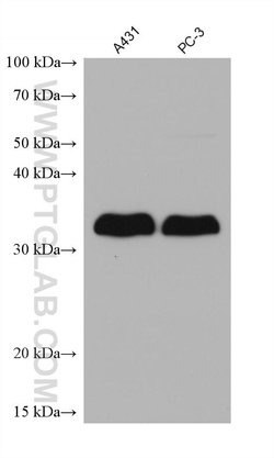 LASP1 Mouse anti-Human, Clone: 1G4B6, Proteintech:Antibodies:Primary Antibodies