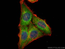 CoraLite Plus 488-conjugated LCK Mouse Monoclonal Antibody, Proteintech 20 &mu;L | Buy Online | Proteintech | Fisher Scientific