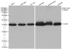 LDHB Rabbit Recombinant Antibody, Proteintech Unconjugated; 100 &mu;L:Antibodies,
