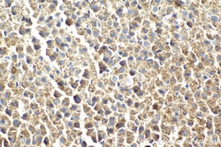 LETM1 Mouse Monoclonal Antibody, Proteintech Unconjugated; 150 &mu;L:Antibodies,